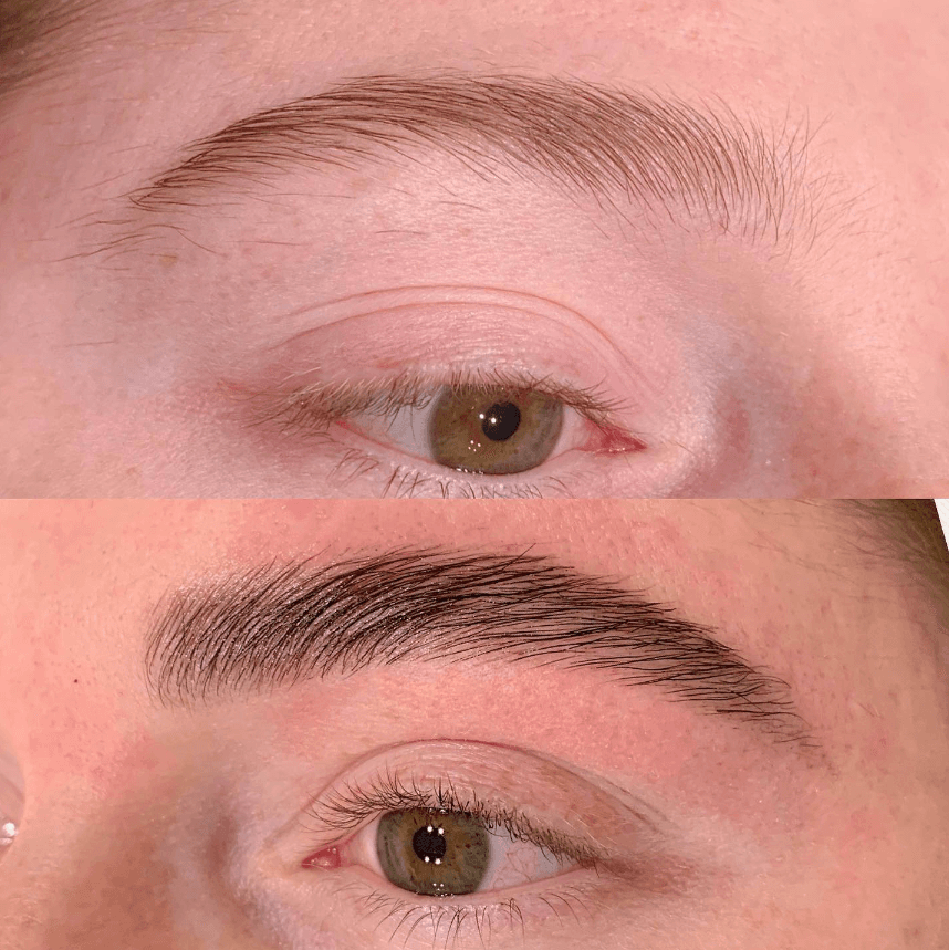 Authentix Beauty and Wellness Clinic — Braddon, Canberra
